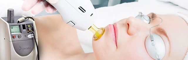 Laser Hair Removal Laser Therapy Springfield VA